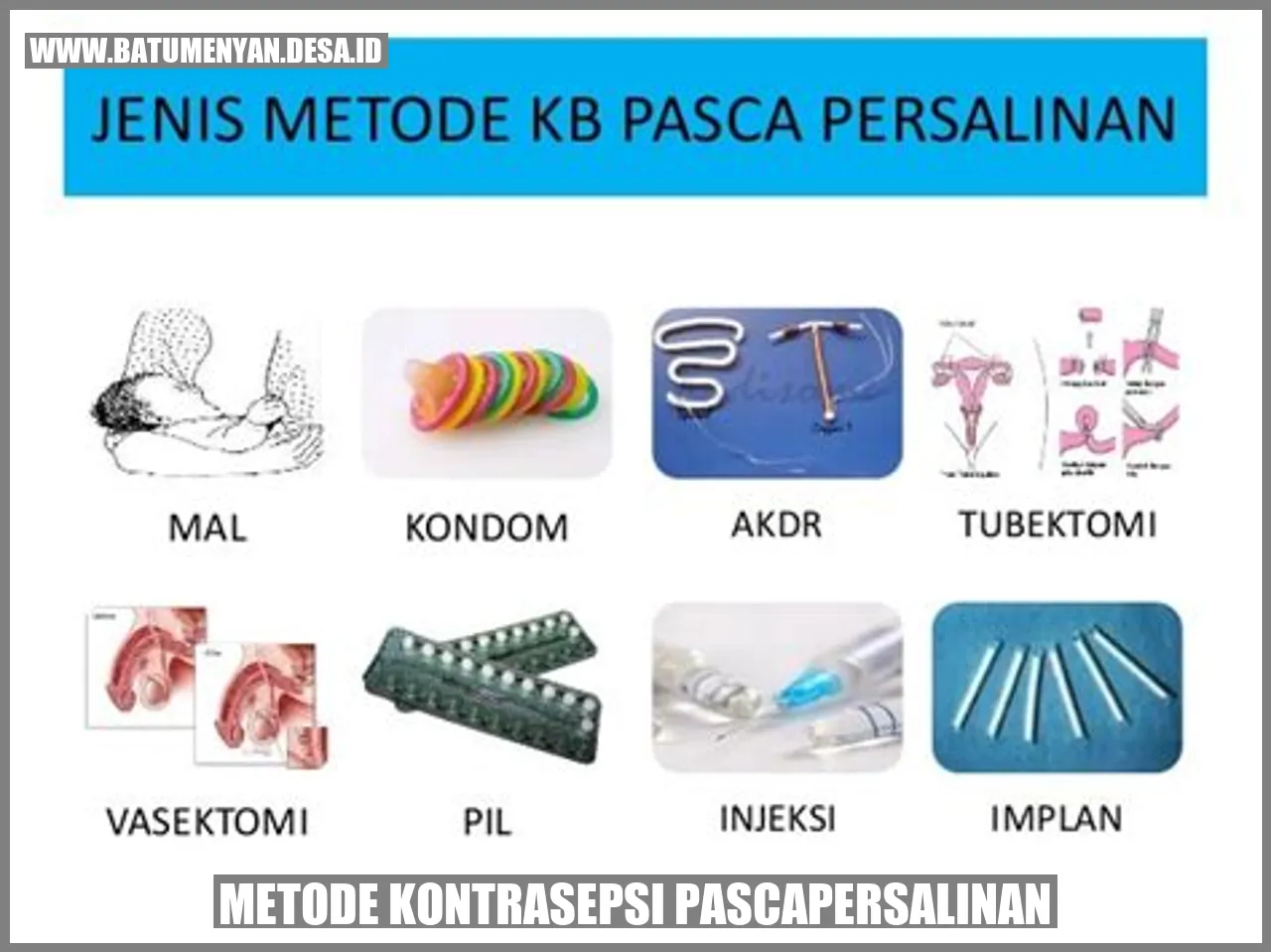 Metode Kontrasepsi Pascapersalinan